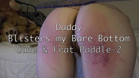 Daddy Beats the Tar out of Me - Blistered and Broken with Frat Paddle and Cane- Two HD 720p